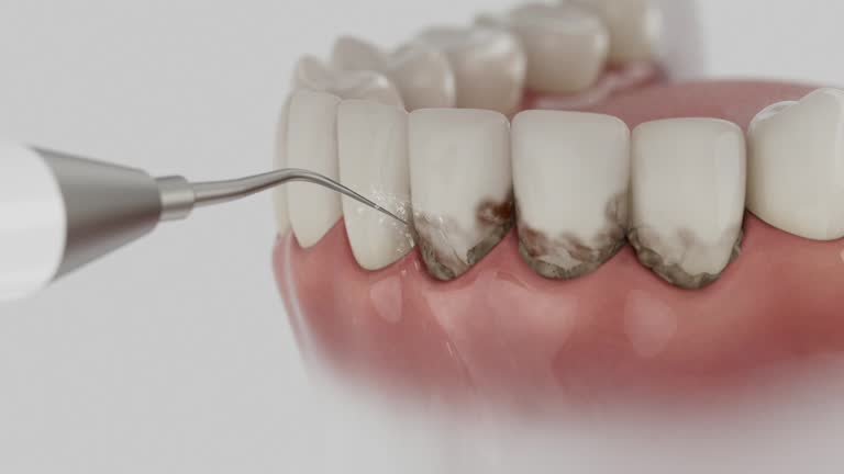 Reliable Dental contractor in Lakeshire, MO by Dentist Open Now